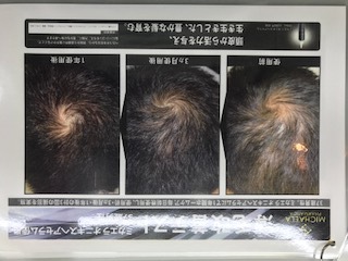 IMG_0472.JPG ayai.JPG